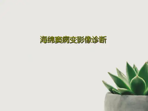 海绵窦病变影像诊断共27页文档