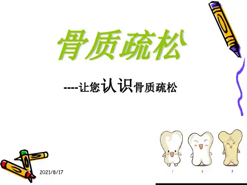 《骨质疏松》PPT课件