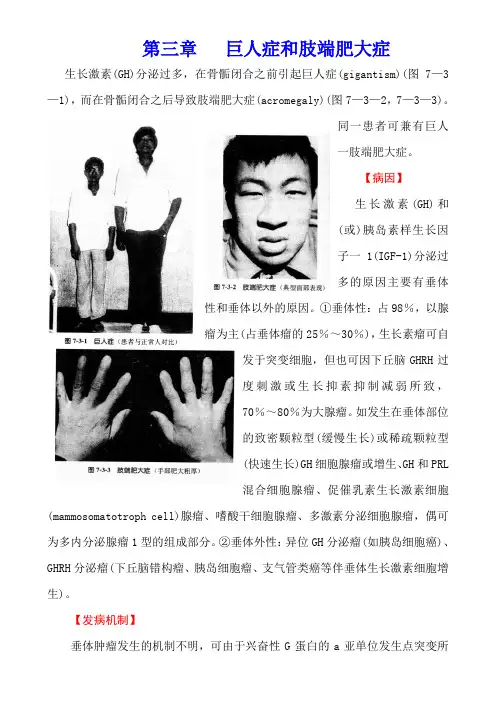 内科学(第七版)内分泌系统疾病第三章   巨人症和肢端肥大症