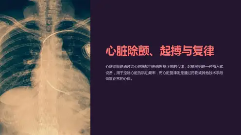 心脏除颤、起搏与复律
