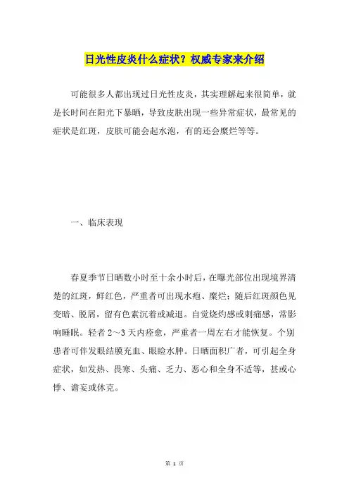 日光性皮炎什么症状？权威专家来介绍