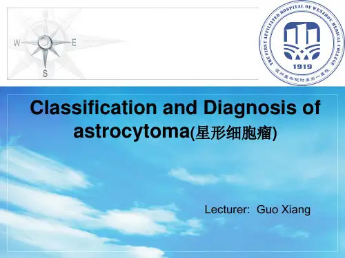 星形细胞瘤