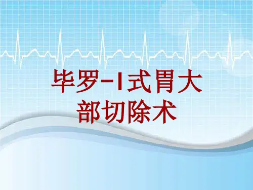 外科手术教学资料：毕罗-I式胃大部切除术讲解模板