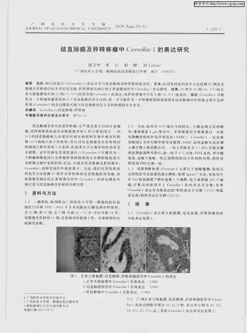 结直肠癌及肝转移瘤中Caveolin-1的表达研究