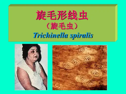 2019年寄生虫课件旋毛虫.ppt