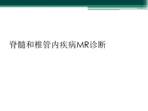 脊髓和椎管内疾病MR诊断