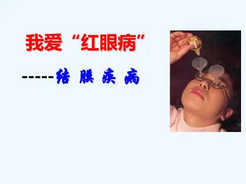 最新精品 结膜疾病ppt眼科学