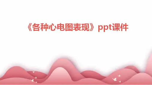 《各种心电图表现》课件