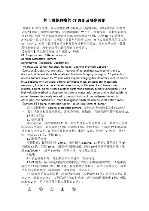 肾上腺转移瘤的CT诊断及鉴别诊断
