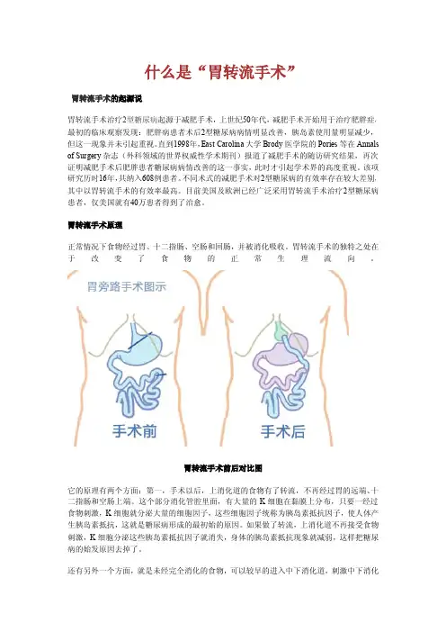 什么是胃转流手术