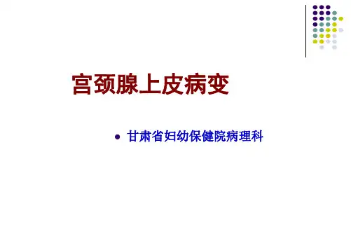宫颈腺上皮病变 2
