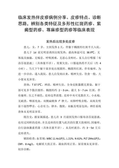 发热伴皮疹病例分享、皮疹特点、诊断思路,辨别特征及多形性红斑药疹、紫癜型药疹、荨麻疹型药疹等临床表现
