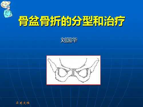 骨盆骨折的分型和治疗