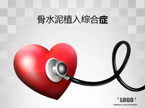 骨水泥PPT课件
