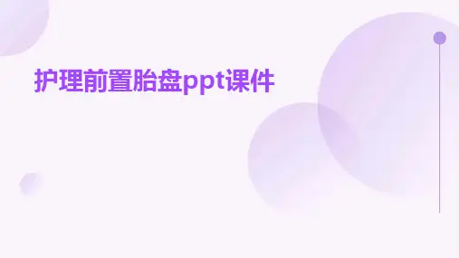 护理前置胎盘ppt课件