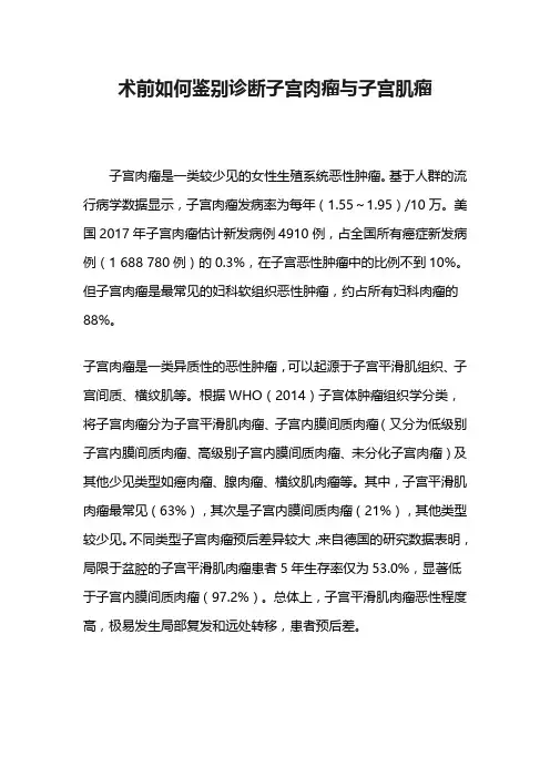 术前如何鉴别诊断子宫肉瘤与子宫肌瘤