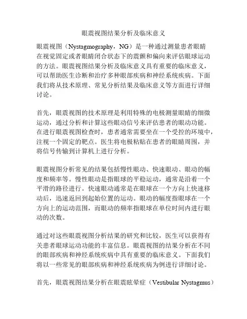 眼震视图结果分析及临床意义 3