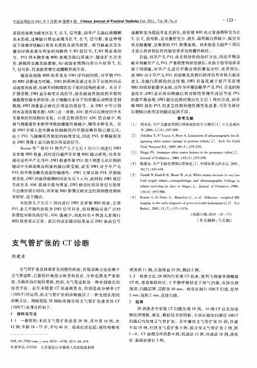 支气管扩张的CT诊断