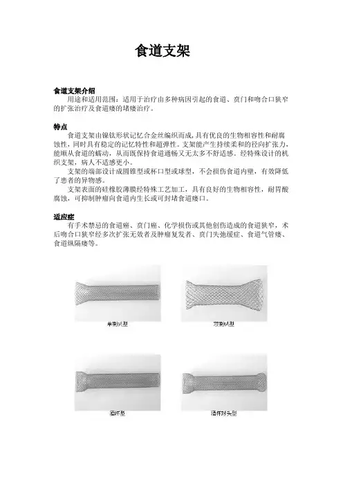 食道支架