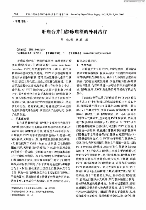 肝癌合并门静脉癌栓的外科治疗