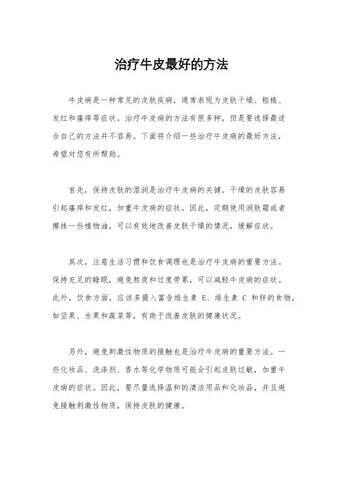 治疗牛皮最好的方法