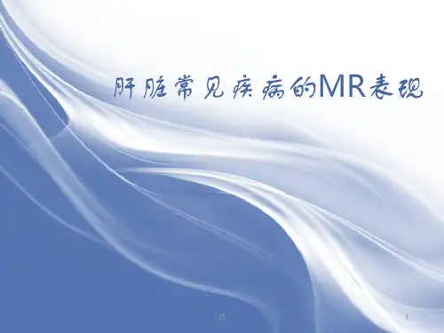 肝脏的MR表现