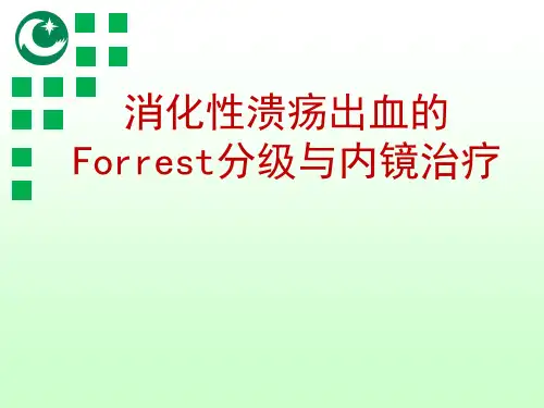消化性溃疡出血的Forrest分级与内镜治疗(修改版)资料