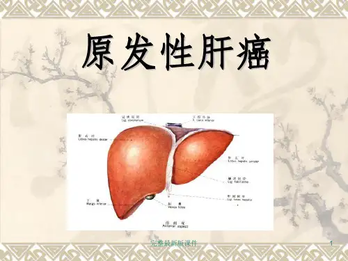 教学查房原发性肝癌ppt课件