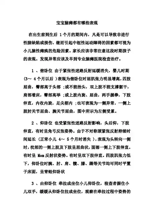 宝宝脑瘫都有哪些表现