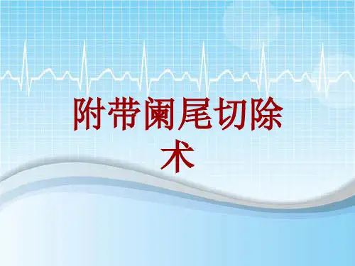 手术讲解模板：附带阑尾切除术