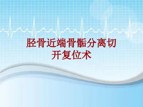 手术讲解模板：胫骨近端骨骺分离切开复位术