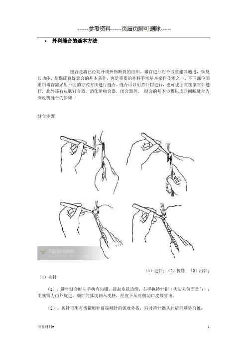 外科缝合的基本方法(优选材料)