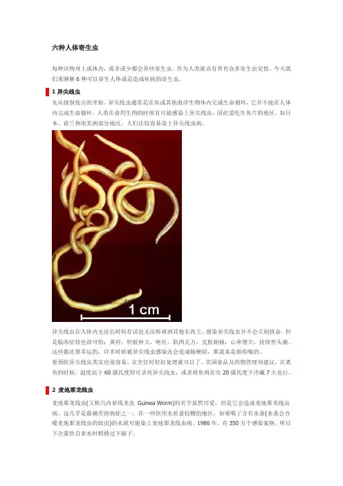 六种人体寄生虫