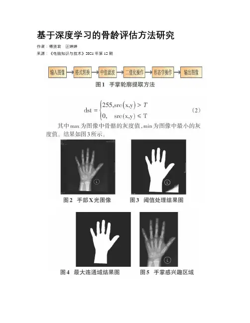 基于深度学习的骨龄评估方法研究