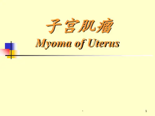 子宫肌瘤病理PPT课件