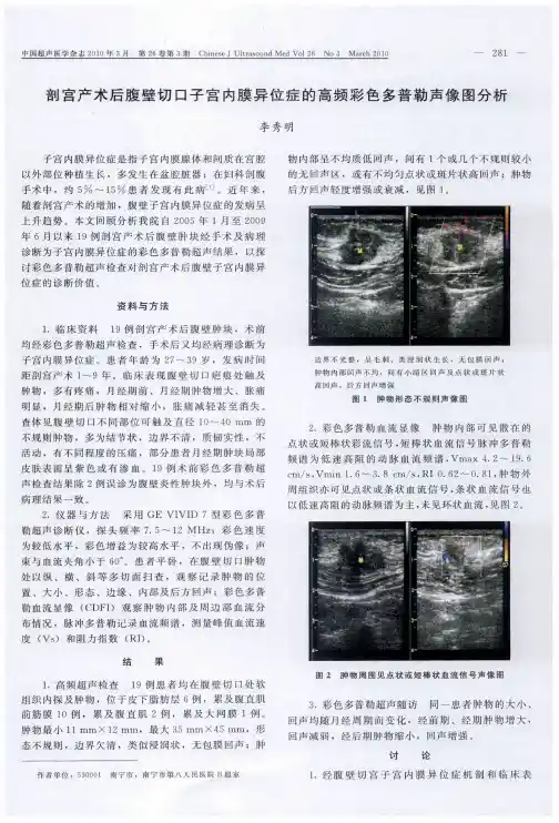 剖宫产术后腹壁切口子宫内膜异位症的高频彩色多普勒声像图分析