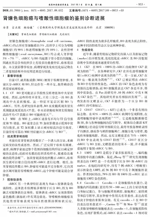 肾嫌色细胞癌与嗜酸性细胞瘤的鉴别诊断进展