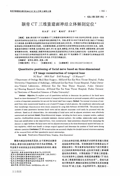 颞骨CT三维重建面神经立体解剖定位