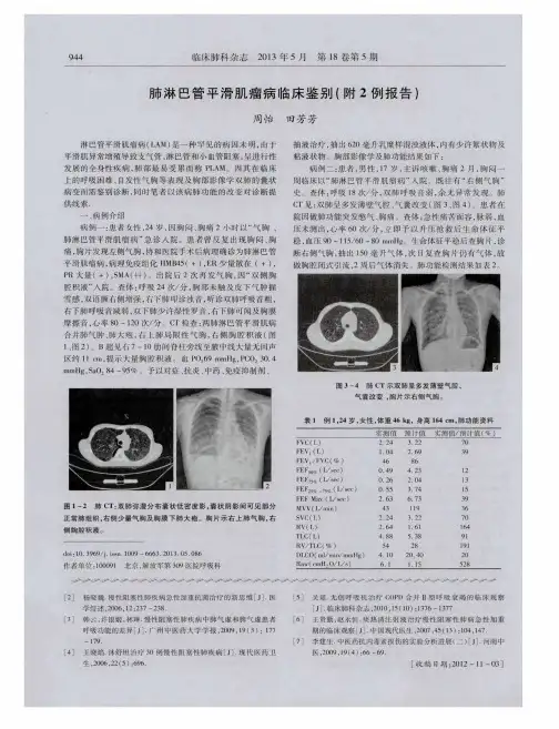 肺淋巴管平滑肌瘤病临床鉴别(附2例报告)