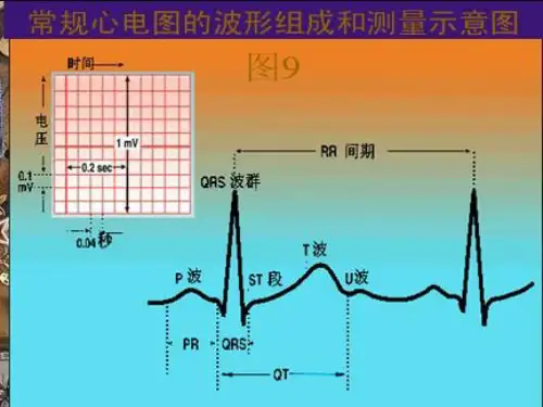医学类教学课件：第三节 心房、心室肥大