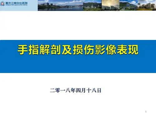 手指肌腱MR-手指解剖及损伤影像表现(特选材料)