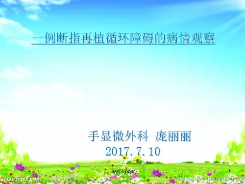 断指再植ppt课件