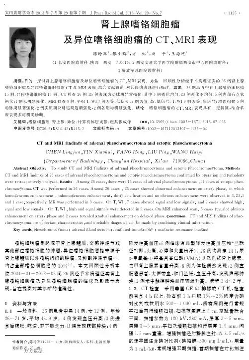 %ba嗜铬细胞瘤及异位嗜铬细胞瘤的CT、MRI表现