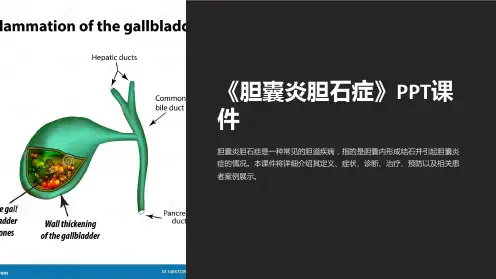 《胆囊炎胆石症》课件