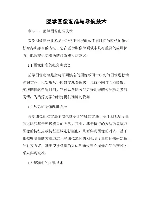 医学图像配准与导航技术
