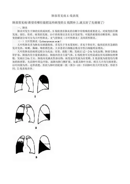 肺部常见病X线表现