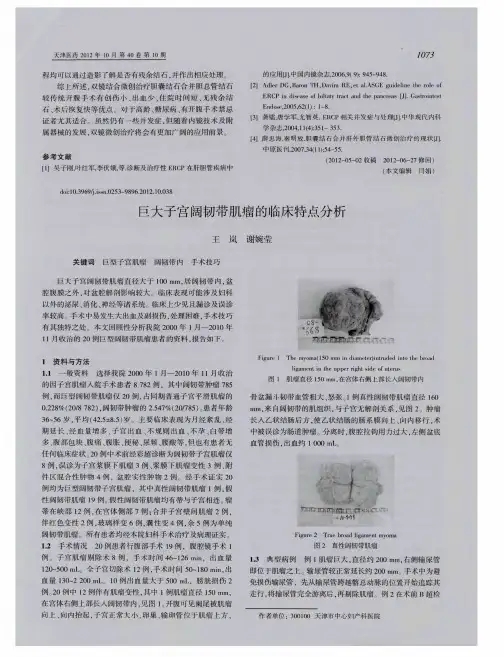 巨大子宫阔韧带肌瘤的临床特点分析