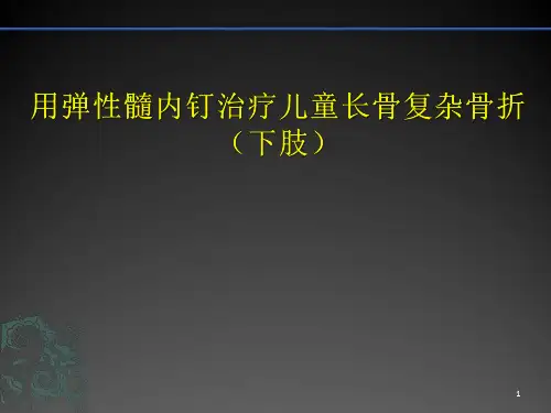 儿童长骨骨折弹性髓内钉PPT幻灯片课件