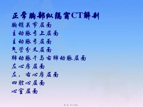 正常胸部CT解剖