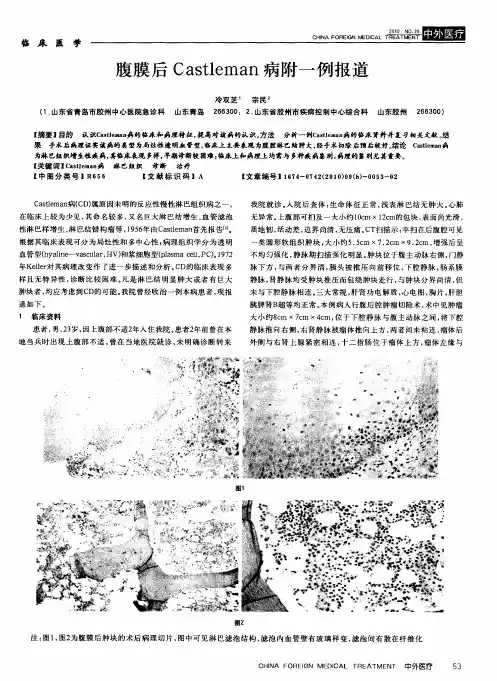 腹膜后Castleman病附一例报道